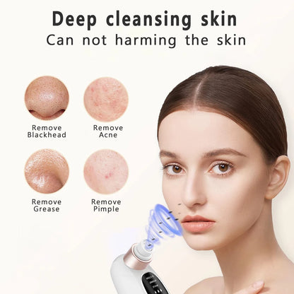 Electric Blackhead Remover – Deep Pore Cleaner & Acne Vacuum Tool (USB Rechargeable)
