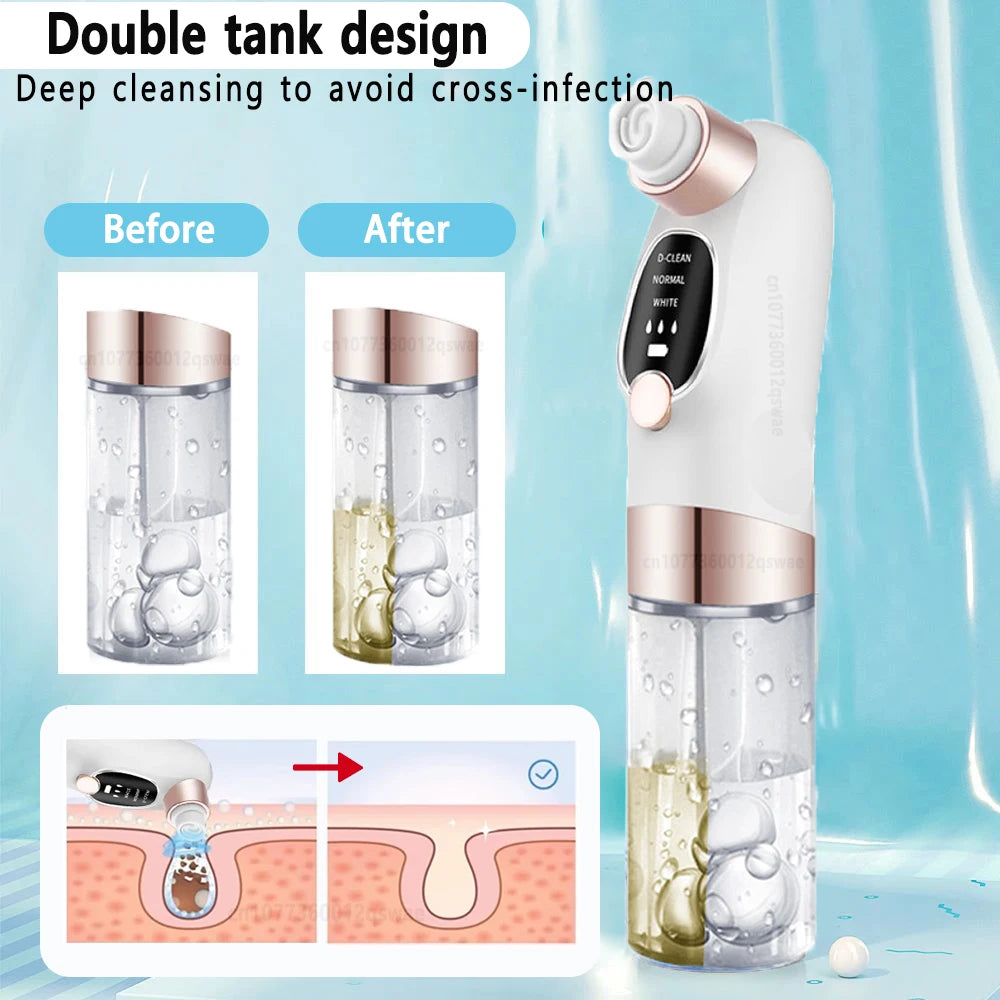 Electric Blackhead Remover – Deep Pore Cleaner & Acne Vacuum Tool (USB Rechargeable)