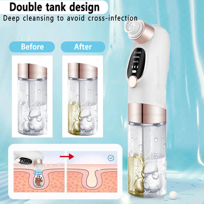 Electric Blackhead Remover – Deep Pore Cleaner & Acne Vacuum Tool (USB Rechargeable)