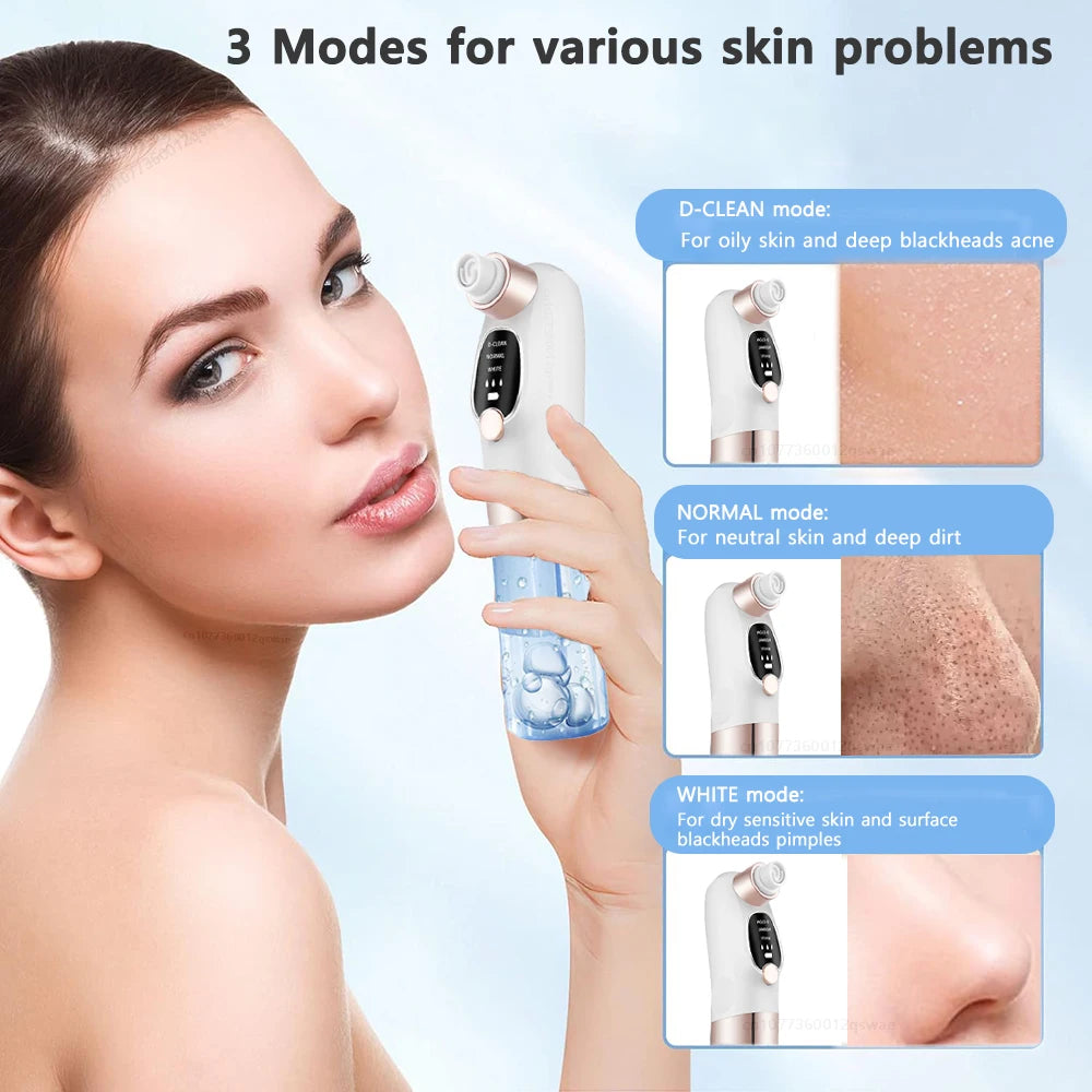 Electric Blackhead Remover – Deep Pore Cleaner & Acne Vacuum Tool (USB Rechargeable)