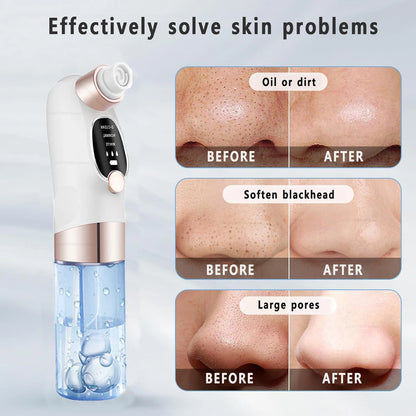 Electric Blackhead Remover – Deep Pore Cleaner & Acne Vacuum Tool (USB Rechargeable)