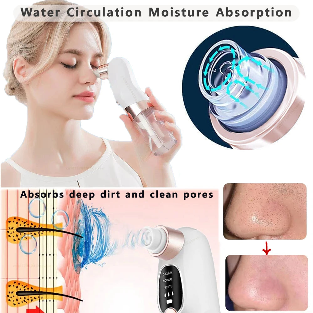 Electric Blackhead Remover – Deep Pore Cleaner & Acne Vacuum Tool (USB Rechargeable)